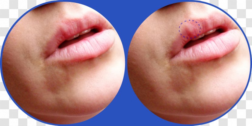 Chin Face Cheek Forehead Lip - Neck - Allergy Transparent PNG