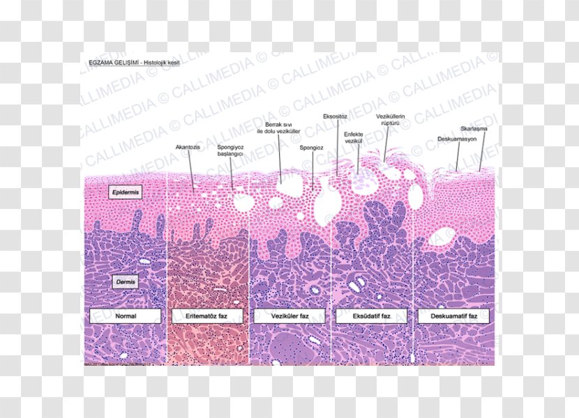 Histology Keratinocyte Dermatitis Corte Histológico Acanthosis - Violet - Microscope Transparent PNG