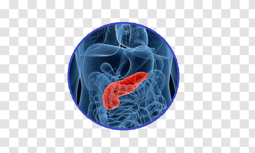 Diabetes Mellitus Pancreas Therapy Pancreatitis Pancreatic Cancer - Surgery - Health Transparent PNG