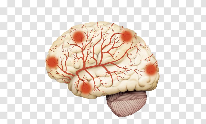 Disease Arteriosclerosis Cerebrum Intracranial Aneurysm Brain - Heart - Hand-painted Meridian Map Transparent PNG