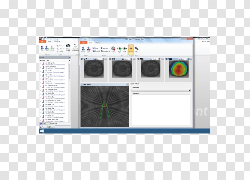 Corneal Topography Surveyor Computer Software Orthokeratology Transparent PNG