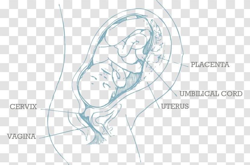 Infant Pregnancy Child Preterm Birth - Tree Transparent PNG
