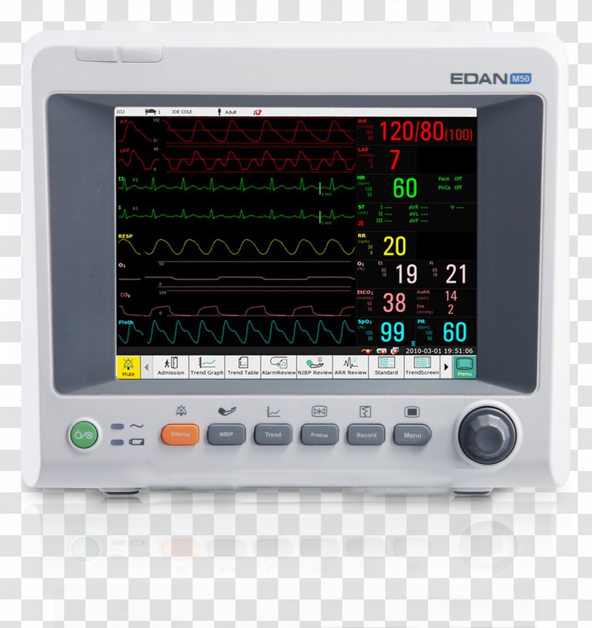 Monitoring Computer Monitors Vital Signs Medical Equipment Hospital - Electronics Accessory - Physician Patient Transparent PNG