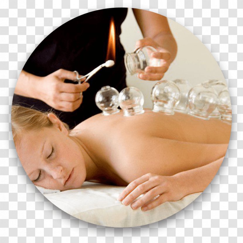 Cupping Therapy Massage Traditional Chinese Medicine Acupuncture - Acupressure Transparent PNG