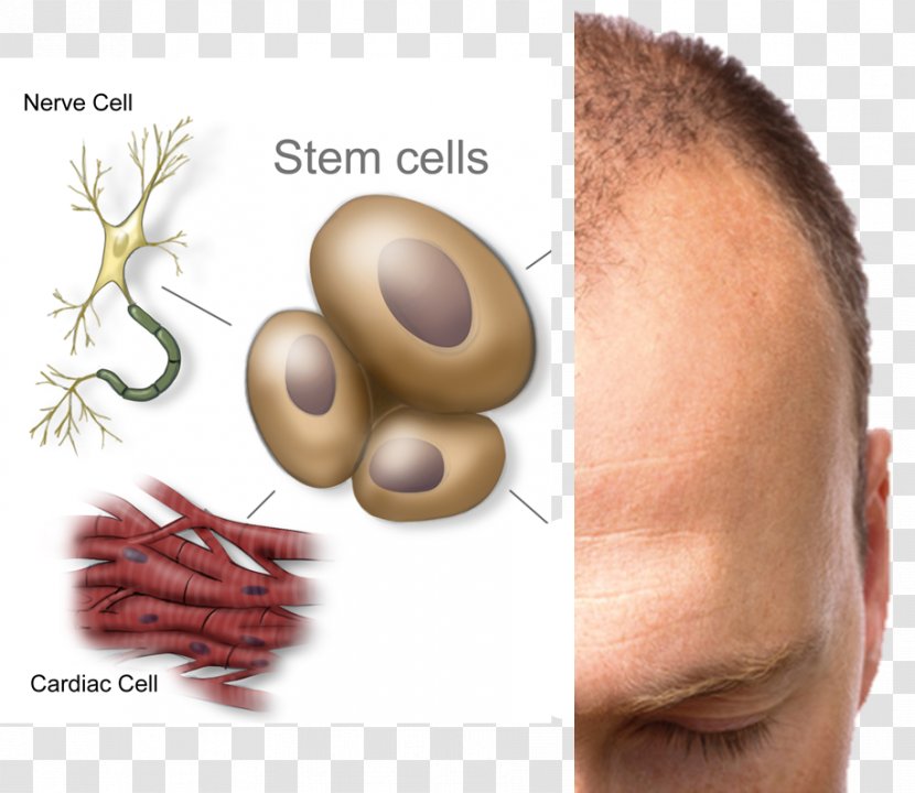 Stem Cell Stem-cell Therapy Disease Cord Blood Bank - Lip - Hair Loss Transparent PNG