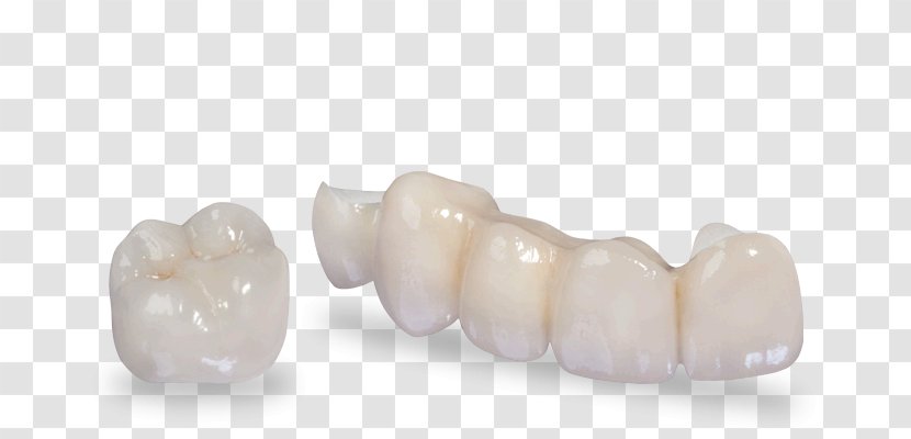 Crown Zirconium Dioxide Dentistry Tooth - Dentist Transparent PNG
