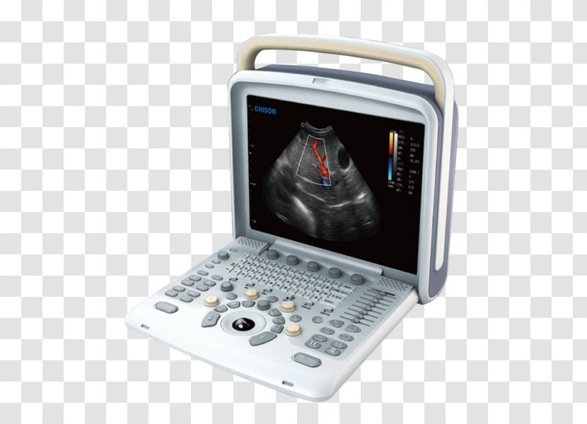 Ultrasonography Portable Ultrasound Doppler Echocardiography Medical Equipment - Sonosite Inc Transparent PNG