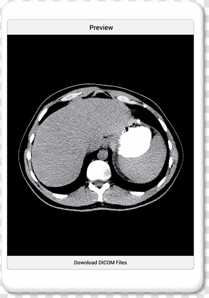 Medical Imaging Computed Tomography PocketSix Technologies Inc. .com Medicine - Health Professional - Ipad Transparent PNG