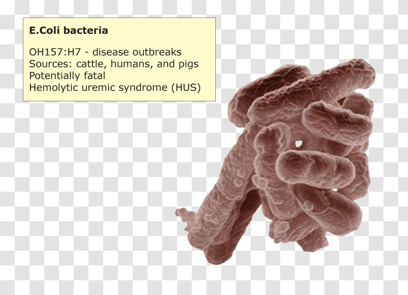 Den 5. Plage Thumb Glove E. Coli Text - Jaw - Enterotoxigenic Escherichia Transparent PNG