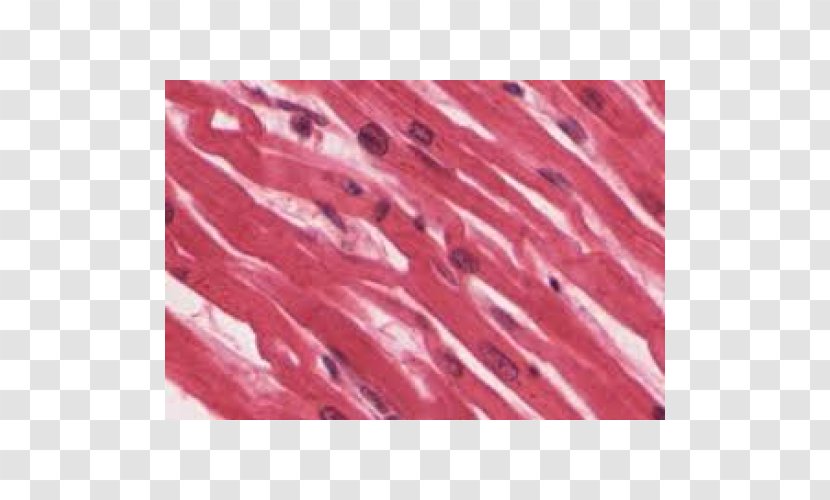 Muscle Tissue Skeletal Cardiac Myocyte - Pink - Striated Transparent PNG