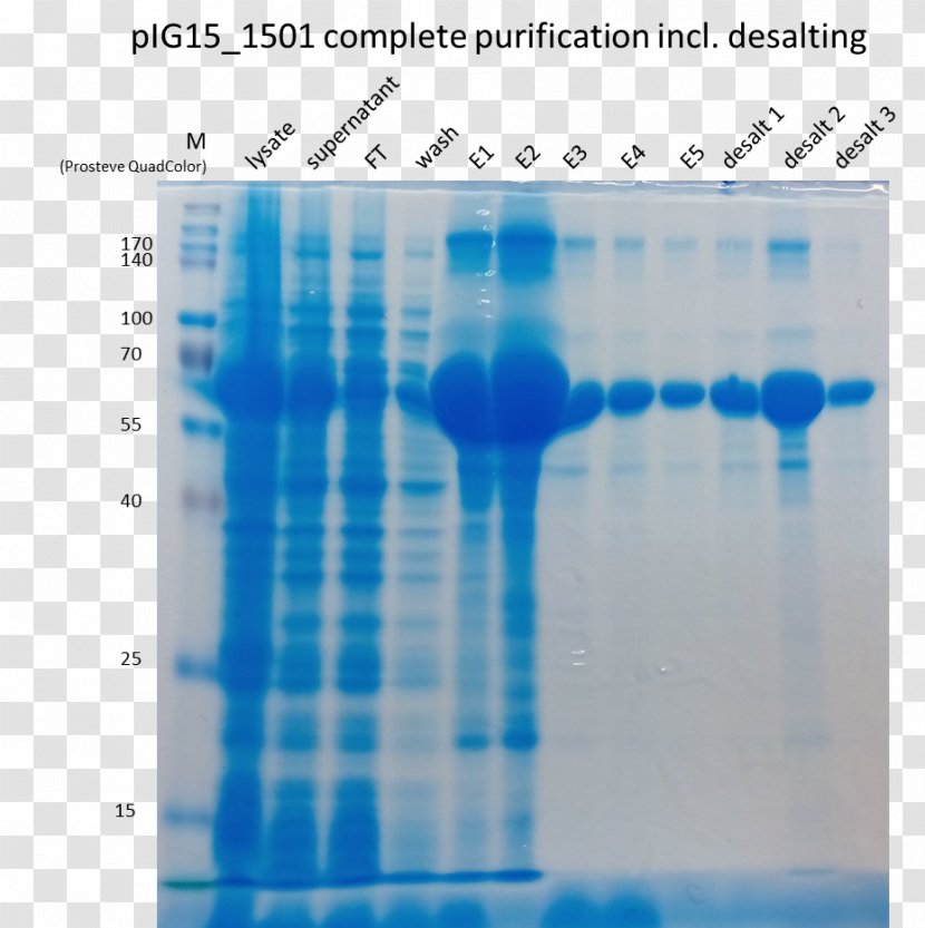 Polyacrylamide Gel Electrophoresis Chromatography Protein SDS-PAGE 岩手県旅館ホテル生活衛生同業組合盛岡支部 - Cell - Falcon Tube Transparent PNG