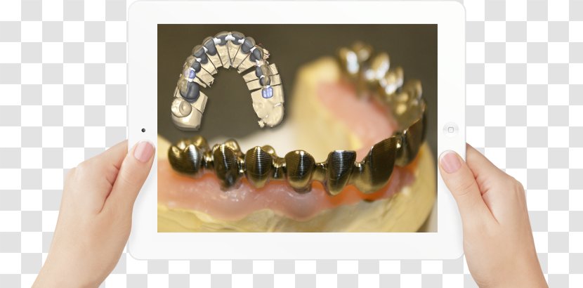 Nail Body Jewellery - Tooth - Dental LAB Transparent PNG