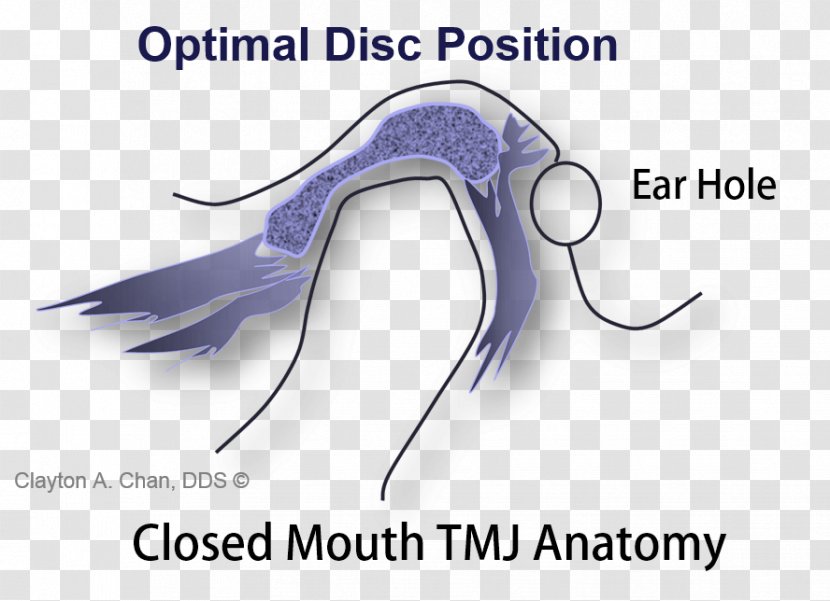 Temporomandibular Joint Dysfunction Syndrome Occlusion Disease - Heart - Watercolor Transparent PNG