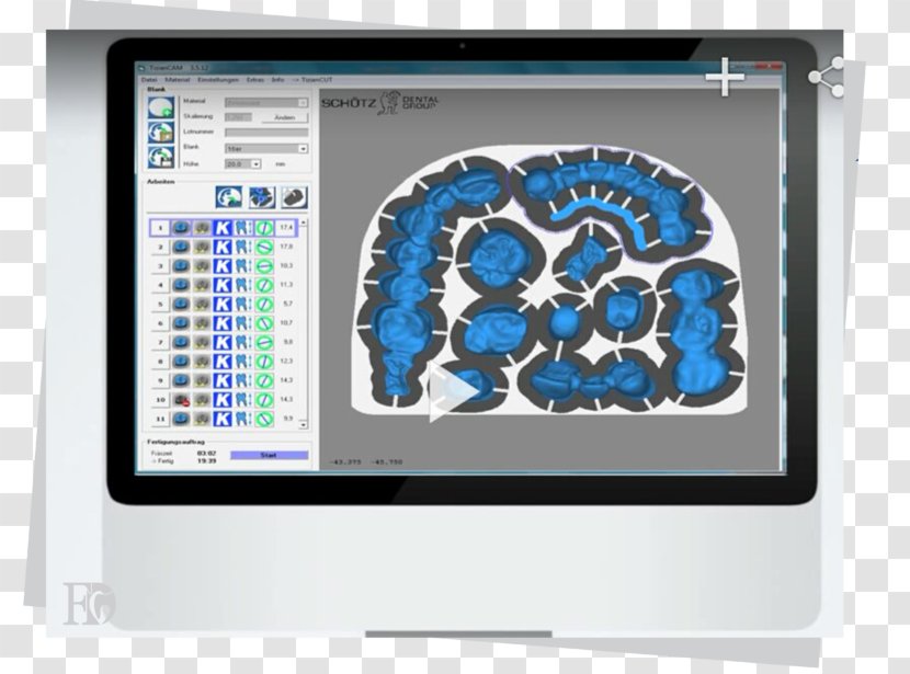 CAD/CAM Dentistry Computer-aided Design Manufacturing Siemens NX Engineering - Brain - Computer Monitor Transparent PNG