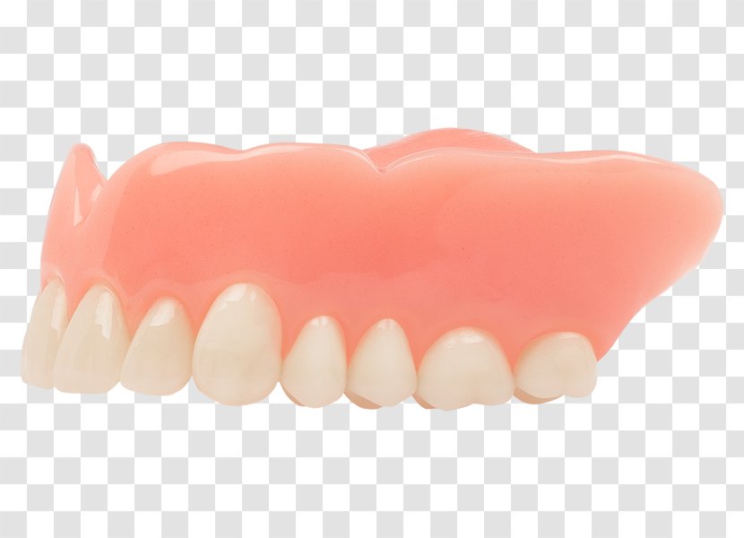 Tooth Dentures Dentistry Human Mouth Aspen Dental - Peach Transparent PNG