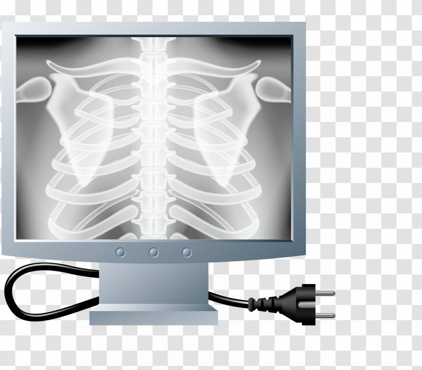 X-ray Rib Bone Cartoon - Health Care - Check Bones Transparent PNG