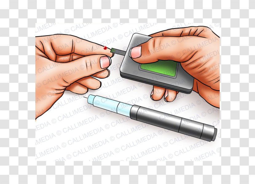 Diabetes Mellitus Blood Sugar Insulin Management Hygiène De Vie - Computer Accessory Transparent PNG