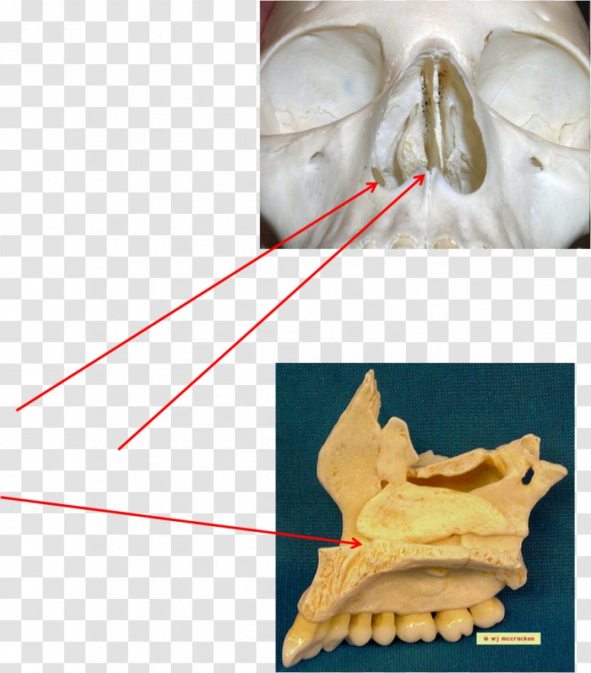 Bone Maxilla Anatomy Joint Skeletal Pneumaticity - Nasal - Skull Transparent PNG