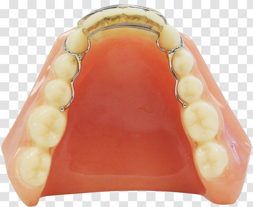 Human Tooth - Jaw - Clear Aligners Transparent PNG