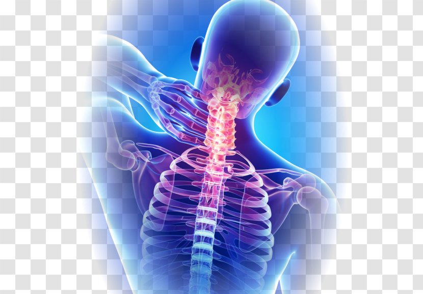 Neck Pain Chiropractic Therapy Medicine - Tree Transparent PNG
