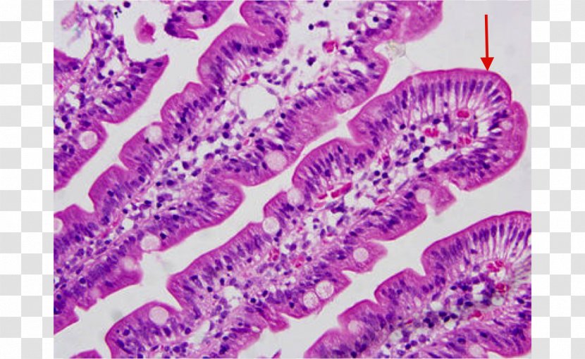 Microvillus Small Intestine Duodenum Histology Microscope Slides - Silhouette - Irregular Border Transparent PNG