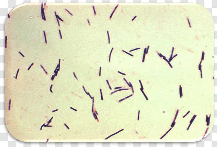 Clostridium Perfringens Food Poisoning Bacteria Botulinum Difficile - Tetani Transparent PNG