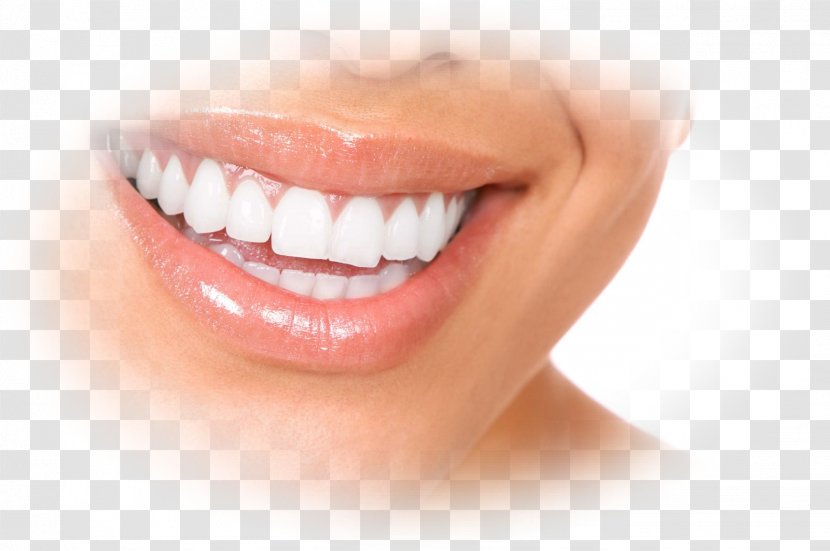 Dentures Dentistry Gums Dental Implant - Dentist - Dent Transparent PNG