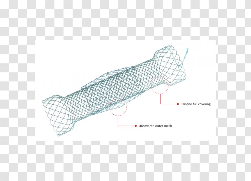 Stenting Esophageal Varices Esophagus - Price - Taewoong Medical Co Ltd Transparent PNG