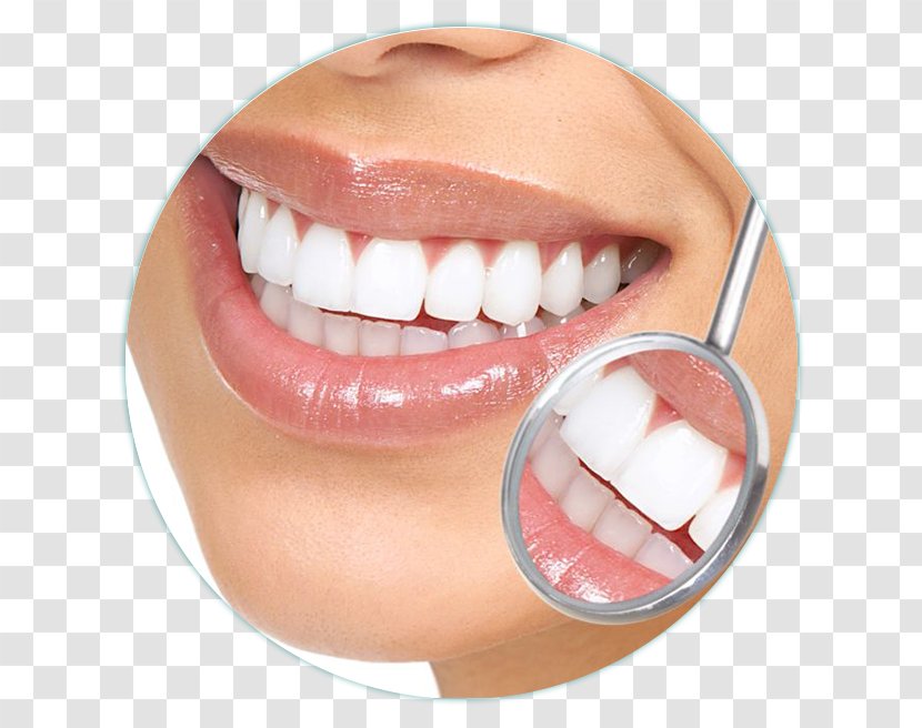 Cosmetic Dentistry Tooth Dental Implant - Dentist - Dentista Transparent PNG