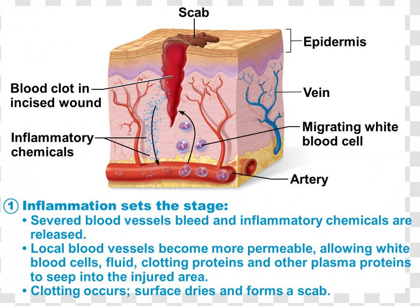 Regeneration Organism Tissue Inflammation - Silhouette - Cartoon Transparent PNG