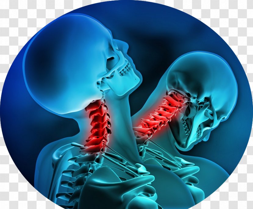 Whiplash Auto Injury Specialists Of Florida Neck Pain Chiropractic - Accident Transparent PNG