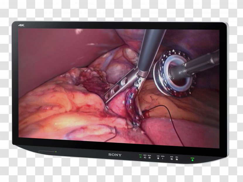 Computer Monitors Sony Corporation 4K Resolution Surgery Television - Display Device - 4k Wallpaper Transparent PNG