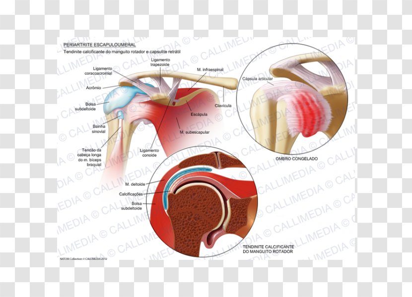 Adhesive Capsulitis Of Shoulder Arthritis Periartrite Scapolo-omerale Rheumatology Ache - Flower - Scapula Transparent PNG