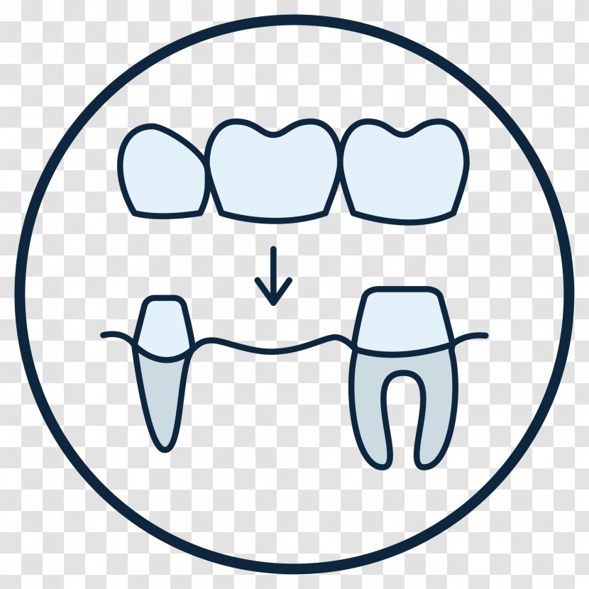 Tooth Dentist Crown Dentures Streeter Dental - Tree Transparent PNG