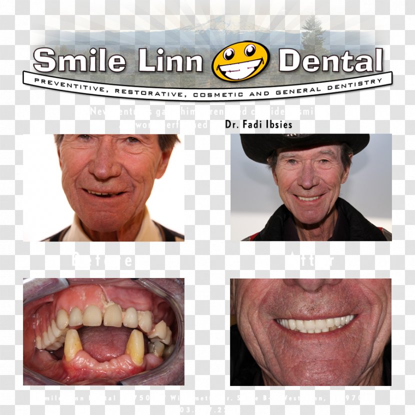 Smile Linn Dental: Ibsies Fadi B DMD Dentistry Tooth Willamette River - Jaw - Lenz Lawrence J Dds Transparent PNG