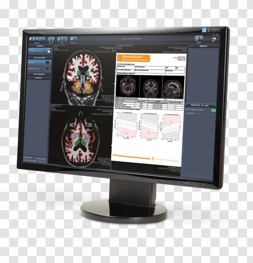 Computer Monitors Multimedia Monitor Accessory - Display Device - Design Transparent PNG