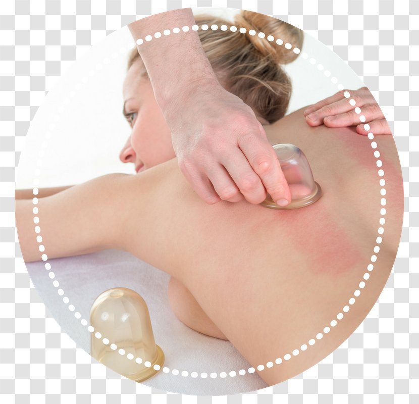 Cupping Therapy Alternative Health Services Bekam Medicine Massage - Watercolor Transparent PNG