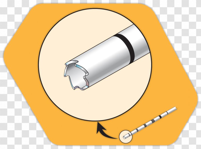 Biopsy Bone Marrow Examination Joint - Lesion Transparent PNG