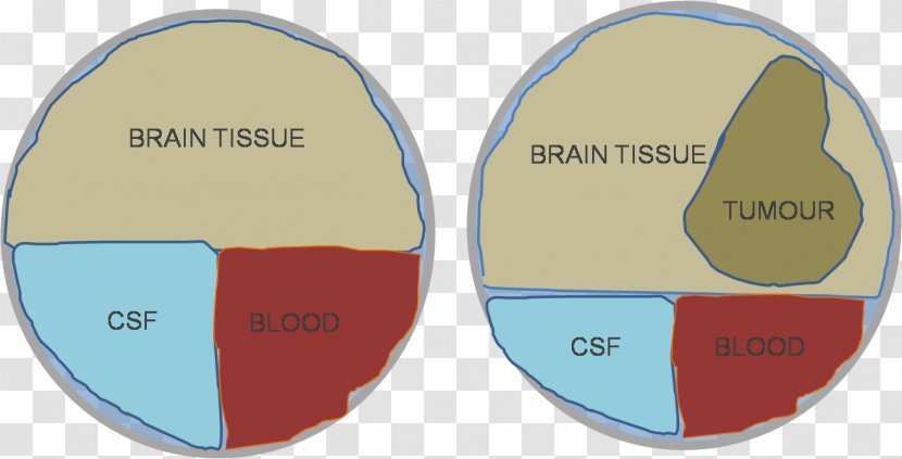 Doktryna Monro-Kelliego Brain Cerebrospinal Fluid Blood Hypothesis - Radiology Transparent PNG