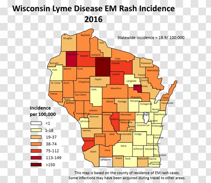 Lyme Disease Tick-borne Human Granulocytic Anaplasmosis - Massachusetts Department Of Public Health - Tickborne Transparent PNG