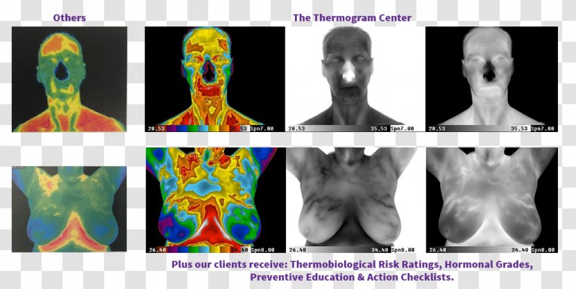 Thermography Medical Imaging Human Body Medicine - Cartoon - Flower Transparent PNG