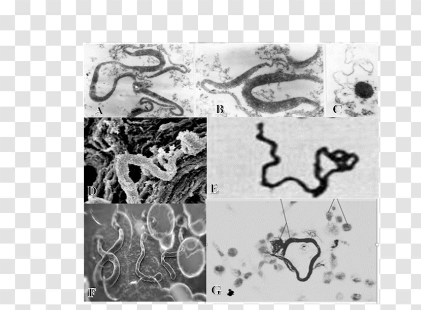L-form Bacteria Microscope Virus Tuberculosis - Drawing Transparent PNG