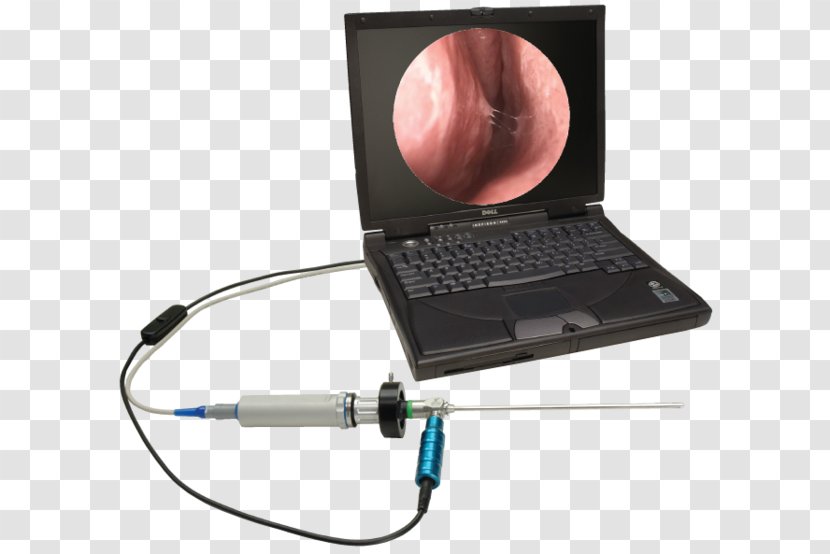 Capsule Endoscopy Otorhinolaryngology Video Cameras Physician - Ophthalmology - Digicam Transparent PNG