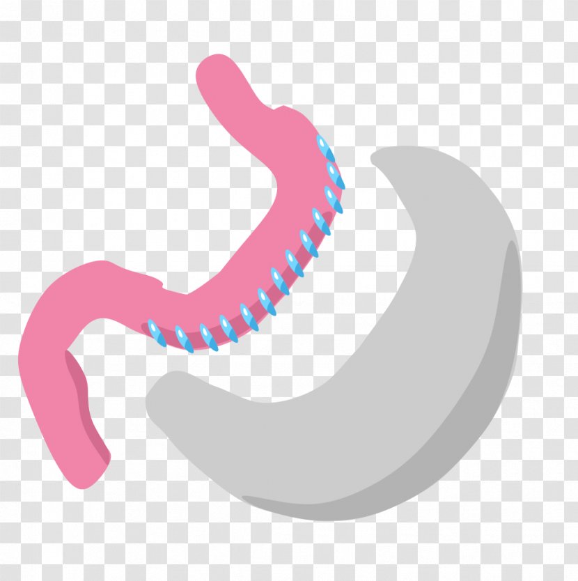 Sleeve Gastrectomy Gastric Bypass Surgery Bariatric - Frame Transparent PNG