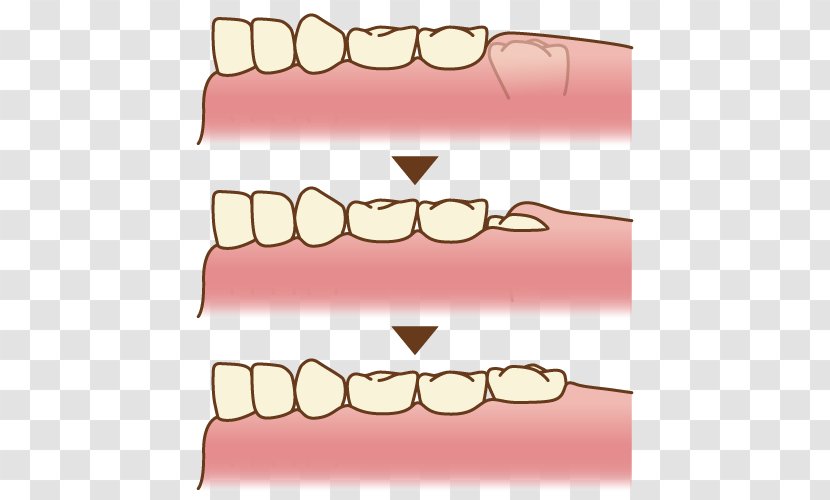 Tooth Molar Dentistry Clip Art - Cartoon Transparent PNG