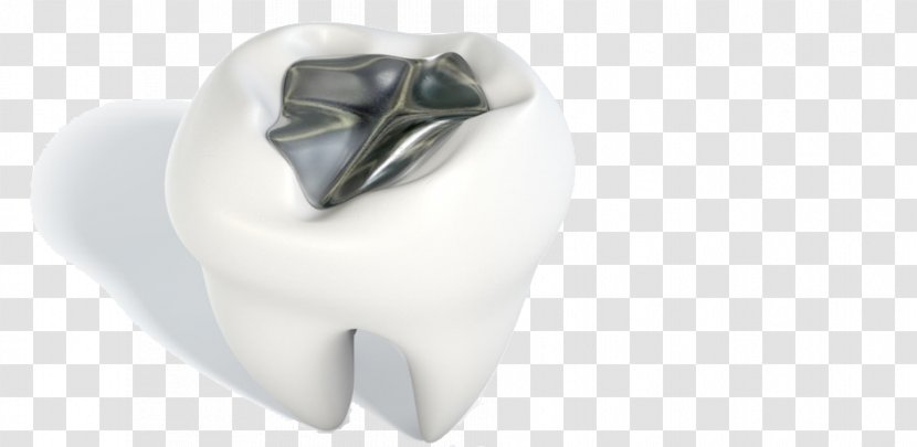 Tooth Amalgam Silver Dentistry Metal - Silhouette - Decayed Transparent PNG