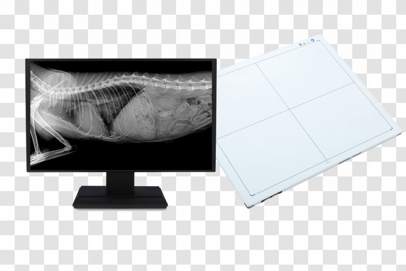 Digital Radiography Medical Imaging X-ray Radiology - Xray Transparent PNG