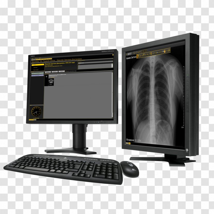 Health Technology System Computer Hardware Medicine - Monitor Accessory - Dentistry Transparent PNG