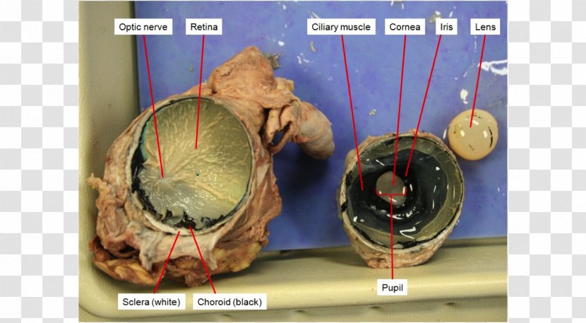 Dissection Cattle Anatomy Human Eye - Tree - Luminescent Blue Glow Iris Can Be Modified Transparent PNG