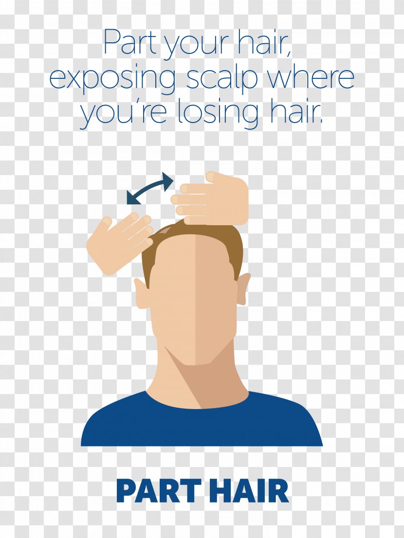 Minoxidil Scalp Management Of Hair Loss - Black Transparent PNG